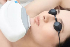  Keunggulan Laser Fotona Untuk Kecantikan Kulit Wajah