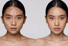 4 Cara Pilih Foundation Sesuai Jenis Jerawat