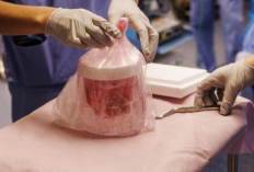 Peneliti AS Semakin Dekat Wujudkan Transplantasi Ginjal Babi untuk Manusia
