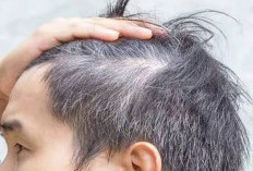 Singkirkan Uban di Rambut dengan Menggunakan 3 Bahan Alami Ini