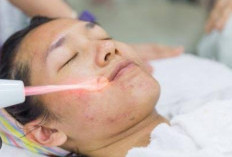 Ini 4 Perawatan Wajah di Salon yang Berisiko Penyakit Kulit