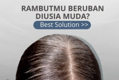 Cara Kurangi Uban Agar Rambut Kembali Hitam Tanpa Perlu Dicat