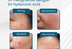 Teknologi AI Masuk Dunia Kecantikan, Rangsang Hiyaluronic Acid Alami