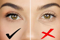  Garis Halus Bawah Mata Sering Bikin Makeup Nge-Crack, Ini Solusinya