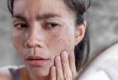 5 Kebiasaan Ini Bisa  Menyebabkan Kulitmu Rusak