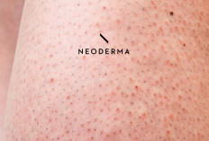 Cara Simpel Hilangkan Strawberry Skin Biar Kulit Kaki Halus