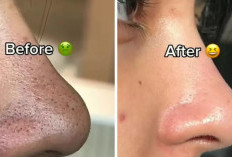 Cara Menghilangkan Komedo di Hidung yang Ampuh