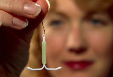 Minat Warga Lebong Tengah Terhadap Kontrasepsi IUD Masih Rendah