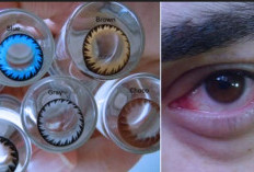 Waspadai Dampak Memakai Makeup dan Lensa Kontak Setiap Hari