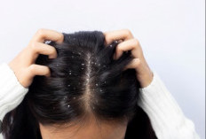 Cara Usir Ketombe dengan 4 Masker Rambut Ini