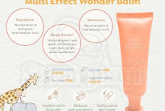  Rekomendasi Skincare Bayi Untuk Kulit Sensitif Cegah Iritasi