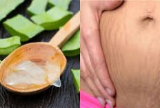  Cara Alami Samarkan Stretch Mark Tanpa Efek Samping