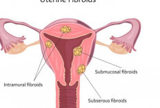 5 Cara Ini Untuk Menjaga Kesehatan Rahim Pada Perempuan