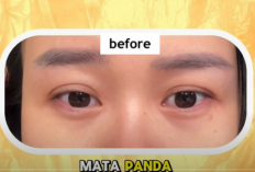 Eye Patch Gel Medis Jadi Solusi Baru Atasi Mata Panda
