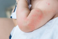 Kulit Sensitif Bayi Butuh Perawatan yang Mengandung Minyak Esensial