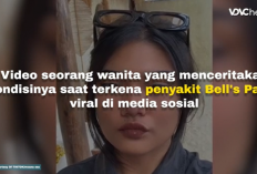 Viral! Sering Pasang Kipas Angin Dekat Wajah, Gadis Ini Terkena Bell’s Palsy