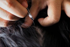 Hati-hati! Ini Bahaya Mencabut Rambut Putih yang Jarang Diketahui