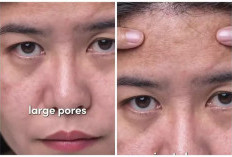  Rahasia Kulit Mulus Bebas Pori-Pori Besar, Ini 5 Tips Skincarenya
