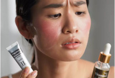 5 Kesalahan Saat Memilih Skincare Untuk Kulit Sensitif