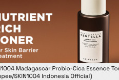 3 Essence Toner Probiotic, Kunci Kulit Auto Lembap!