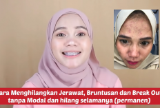 Cara Paling Ampuh Menghilangkan Jerawat, Bruntusan, dan Breakout Tanpa Modal Uang dan Hasil Permanen