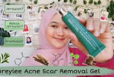   Rekomendasi Krim Penghilang Bekas Jerawat, Ampuh Banget! 
