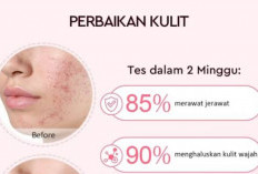 3 Kesalahan Penggunaan Retinol yang Bisa Bikin Masalah Kulit