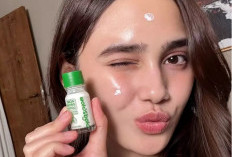 Cara Syifa Hadju Atasi Jerawat di Wajah Agar Cepat Kempis