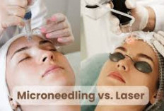 Microneedling vs Skincare, Mana yang Bagus Kecilkan Pori-Pori? 