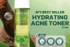 3 Produk Skincare dengan Kandungan Tanaman Herbal untuk Merawat Kulit Berjerawat