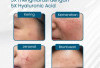 Teknologi AI Masuk Dunia Kecantikan, Rangsang Hiyaluronic Acid Alami