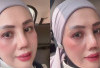 Soal Alasan Operasi Plastik, Elly Sugigi: Hidung Aku Agak Miring