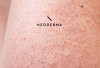 Cara Simpel Hilangkan Strawberry Skin Biar Kulit Kaki Halus