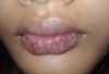 Kenapa Bibir Sering Kering? Ini 3 Penyebab Utamanya