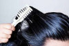  Rambut Mudah Berminyak? Ini Solusi yang Bisa Kamu Coba! 
