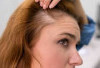 5 Tips Bikin Batang dan Akar Rambut Lebih Kuat