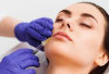  Terlihat Cantik Tapi Bahaya, Ini Efek Samping Filler Bibir